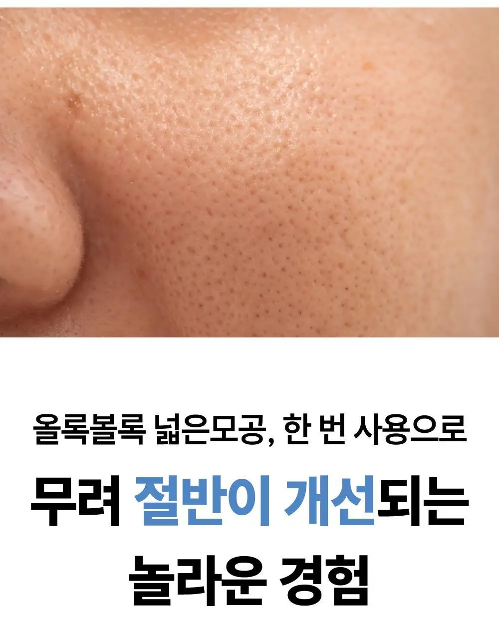 [500억유산균팩] 써니콘 마이크로바이옴 유산균 모델링팩 (7개입) 상세페이지 5